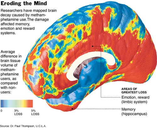 methamphetamine erodes the mind